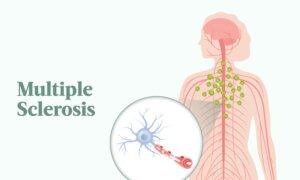 Multiple Sclerosis: Symptoms, Causes, Treatments, and Natural Approaches